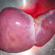 Illustration for article titled 10 Current Medical Procedures our 22nd Century Descendants Will Find Barbaric